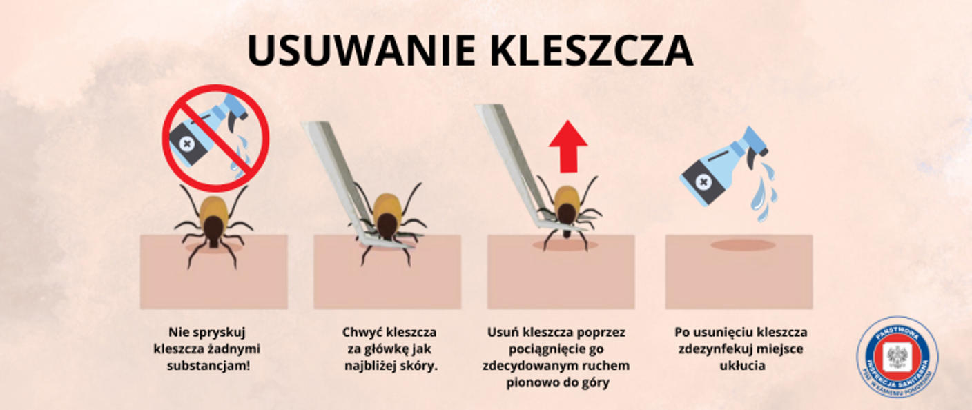 Usuwanie kleszcza